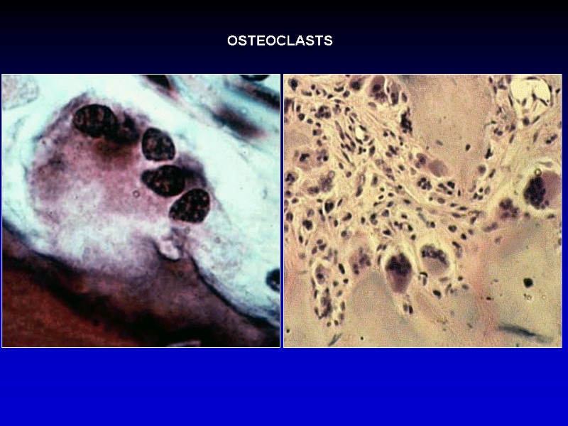 OSTEOCLASTS